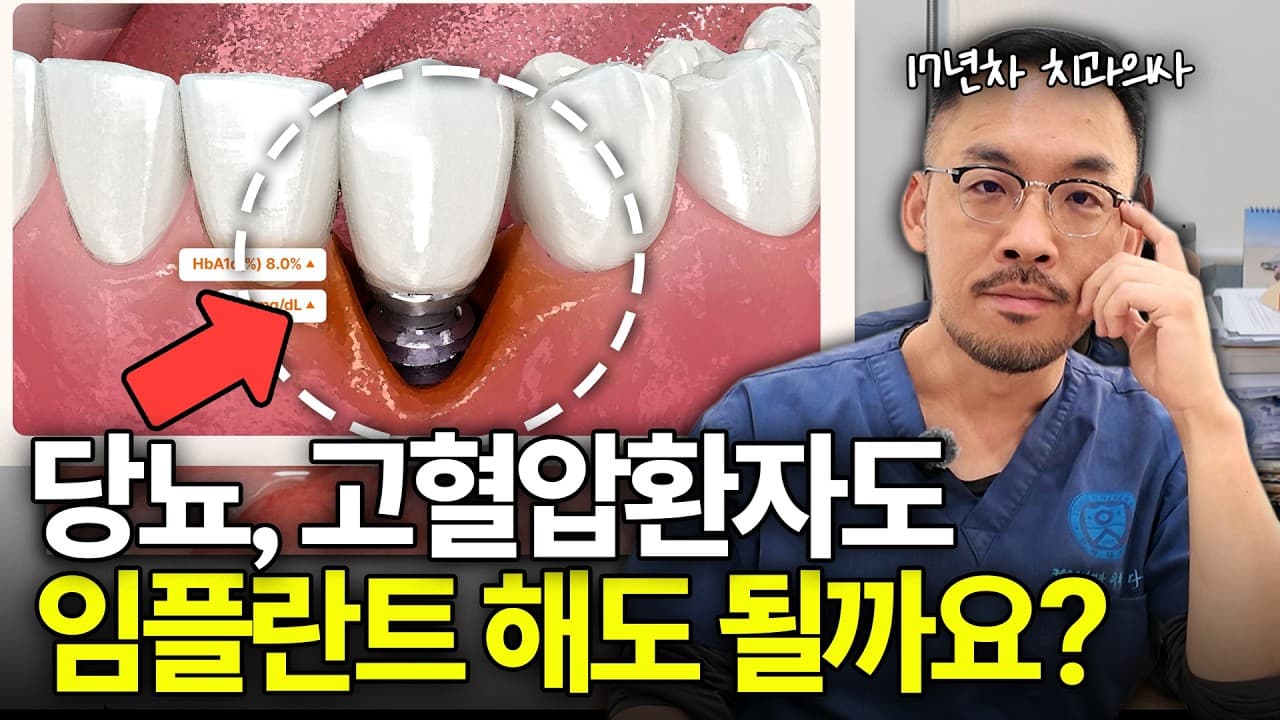 골다공증 주사 맞은 사람, 임플란트 함부로 못 하는 이유