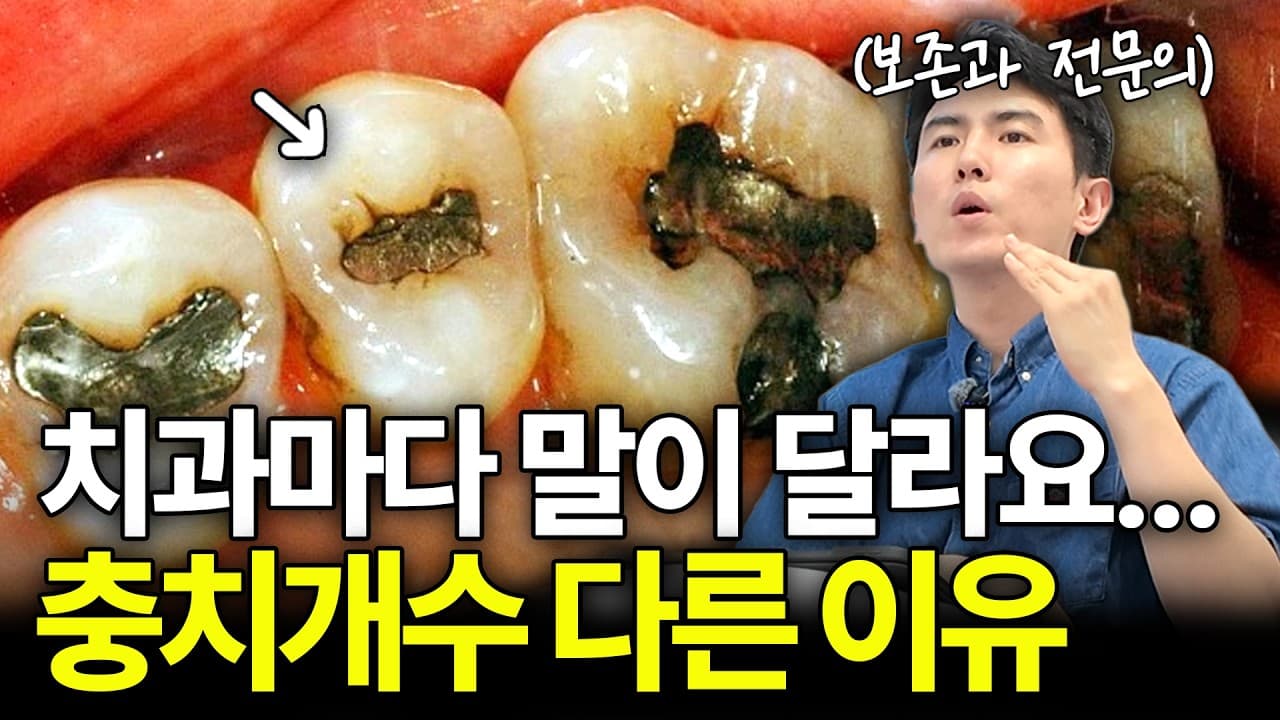 아프지도 않은데 충치 5개? 치과마다 진단 개수 다른 이유 영상 썸네일