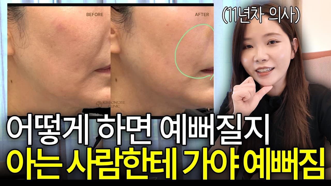 시술 효과 가르는 1mm의 차이, 의사의 미감은 타고날까