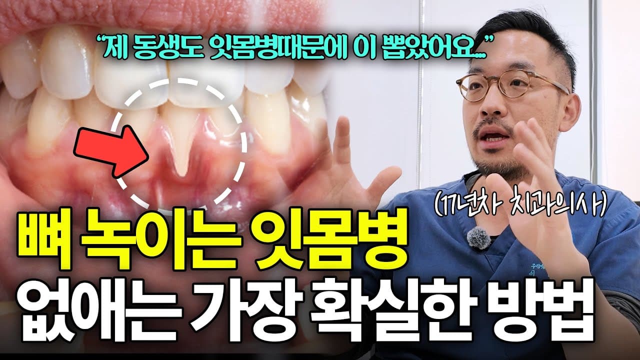 30대 넘어서 이 뽑는 진짜 이유, 충치가 아닙니다
