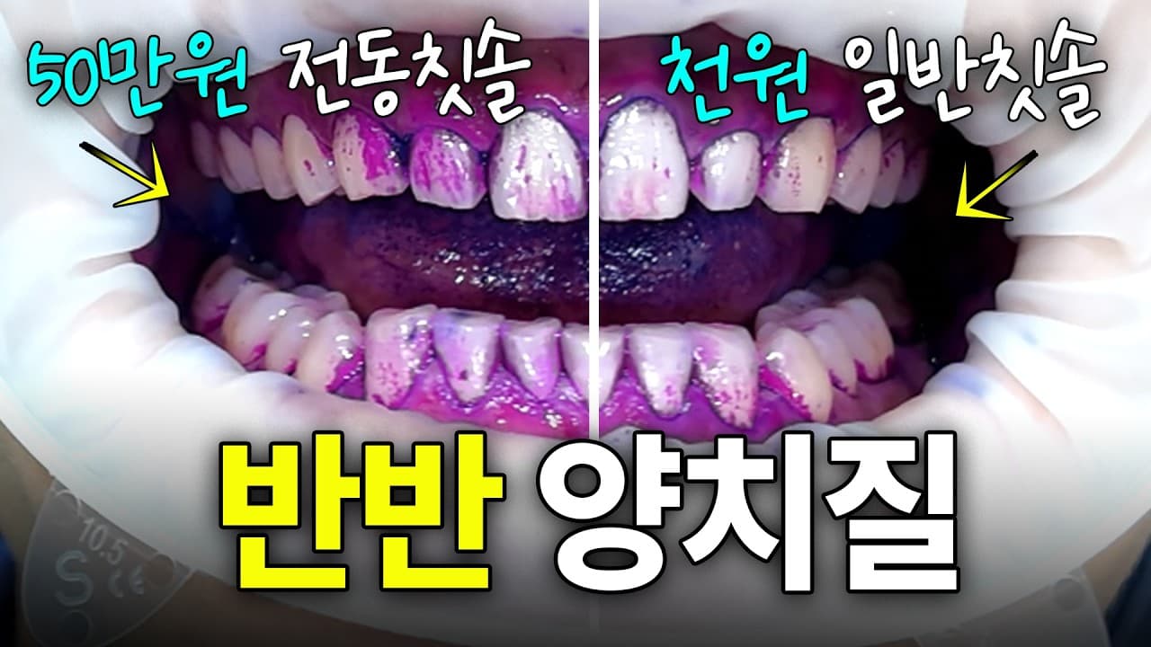 비싼 전동칫솔로 양치해도 잇몸병 생기는 이유