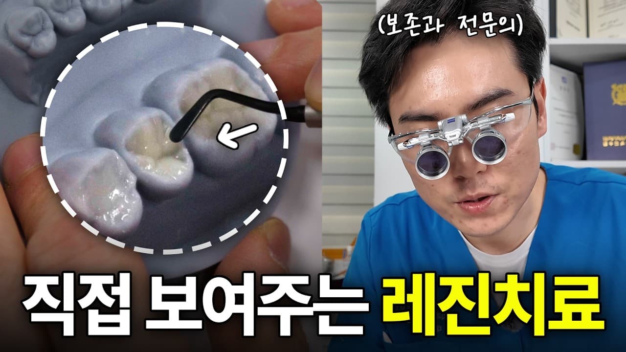 충치 떼운 뒤 음식이 안 씹힌다면, 레진의 형태를 살펴라 영상 썸네일