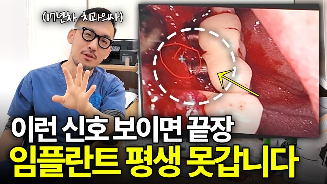 임플란트 주위염, 뼈 다 녹아도 안 아픈 이유