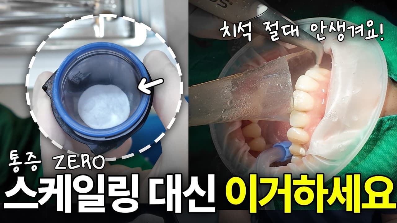 양치해도 남는 치아 표면 찌꺼기, 치석 되기 전 관리법 영상 썸네일