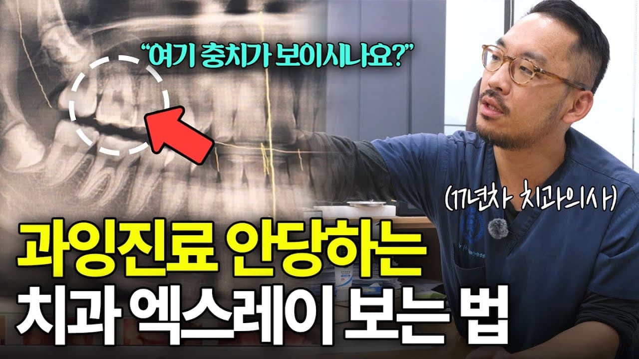임플란트 주변 뼈가 다 녹아도 통증이 없는 이유